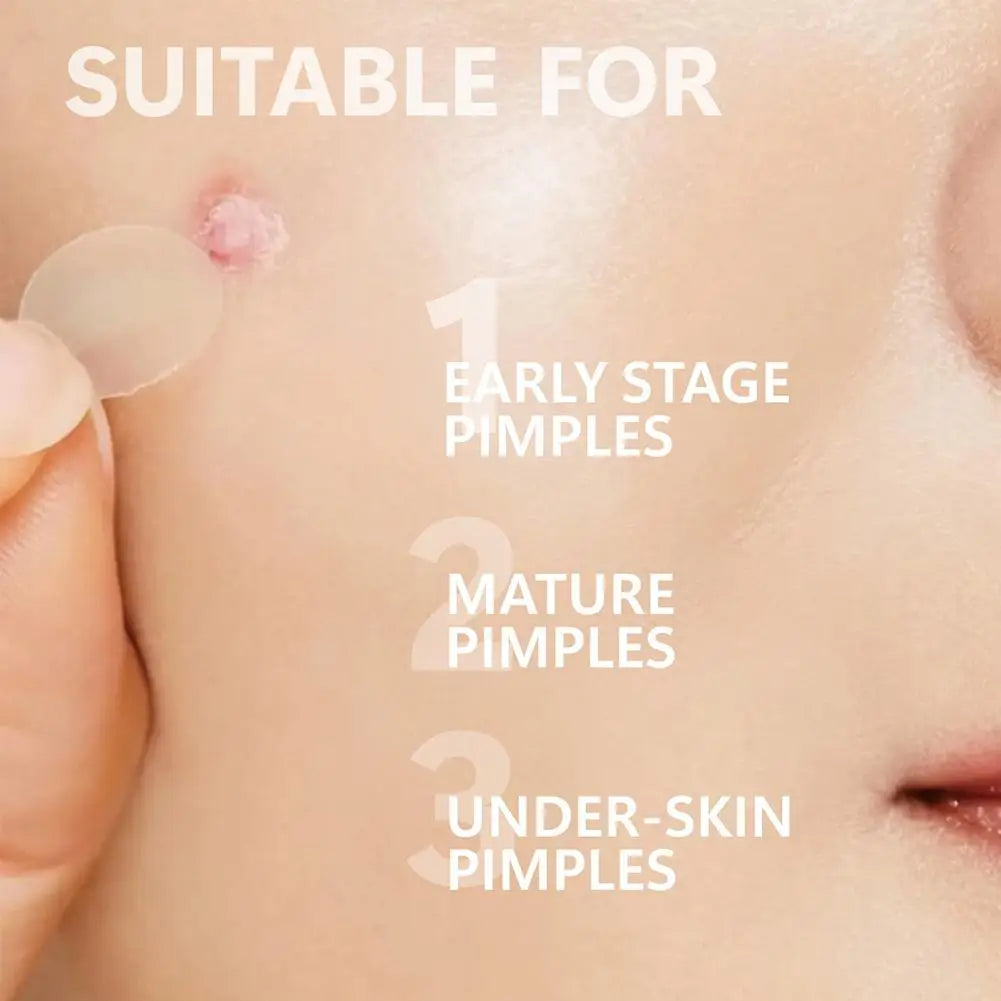 12/24PCS Microneedle Acne Patch Hydrocolloid Invisible Rounded Corner Acne Cover Patches Daily Gentle Skincare Unisex